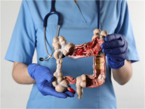 Medical professional holding a colon model close-up.